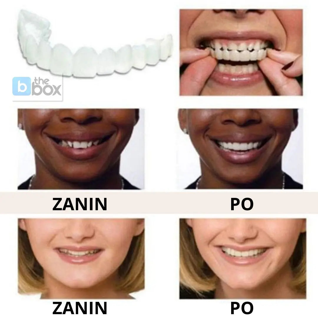 Łatwy Uśmiech - Górne + Dolne Białe Zęby Ana 1