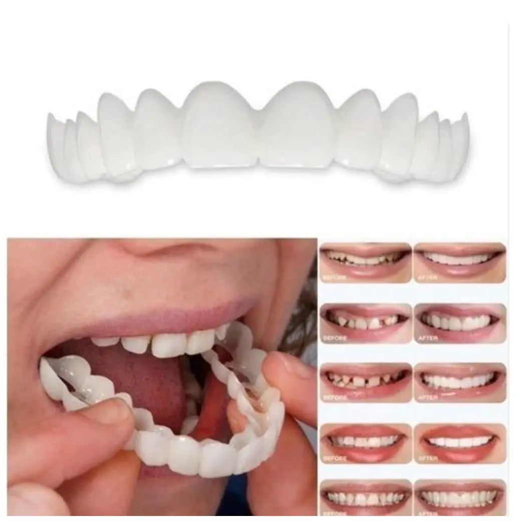 Łatwy Uśmiech - Górne + Dolne Białe Zęby Ana 1